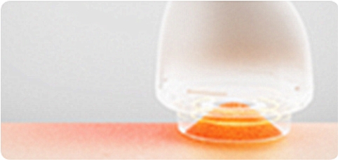 2 AiYiSheng Gua Sha Stone Needle Cupping Massage and Scraping Appliance.jpg