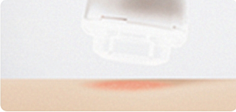 3 AiYiSheng Gua Sha Stone Needle Cupping Massage and Scraping Appliance.jpg