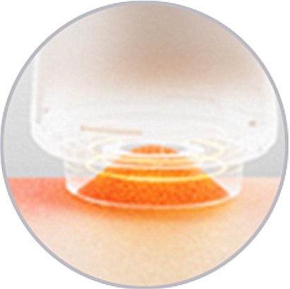 3AiYiSheng  Stone Needle Cupping Massage and Scraping Appliance .jpg