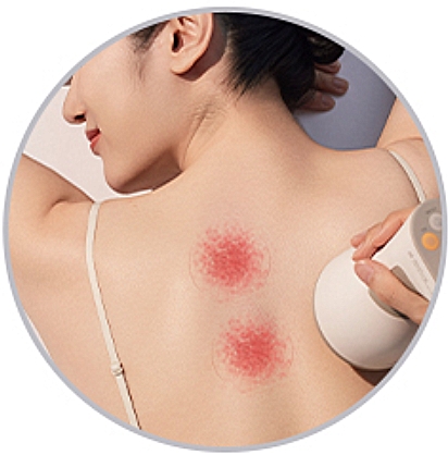 4 AiYiSheng  Stone Needle Cupping Massage and Scraping Appliance .jpg