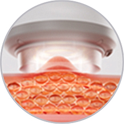 5 AiYiSheng  Stone Needle Cupping Massage and Scraping Appliance .jpg
