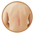 8 AiYiSheng Gua sha Cute Stone Needle Spine Push Appliance.jpg