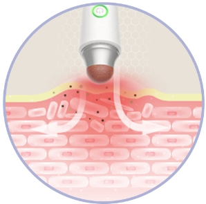 5 AiYiSheng Stone Needle Eyes Massage Appliance.jpg