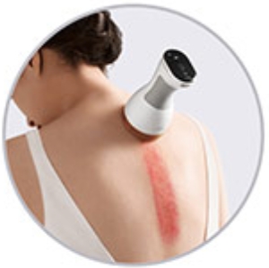 11 AiYiSheng Gua Sha Stone Needle Massage Appliance 3rd Gen.jpg
