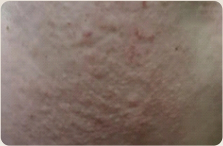 Sha Pattern 6.jpg